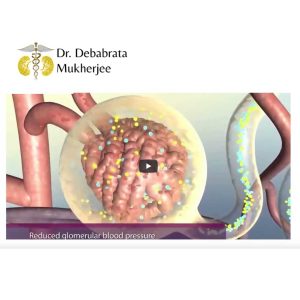 Kidney Specialist
