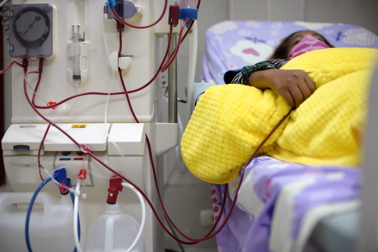 CRRT machine used in ICU by nephrology expert